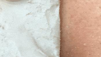 黑头多怎么办如何去除黑头,黑头贴去除顽固黑头