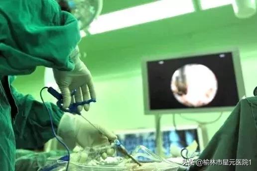 榆林市中医院治腰椎间盘突出症,榆林市治腰椎椎间盘突出