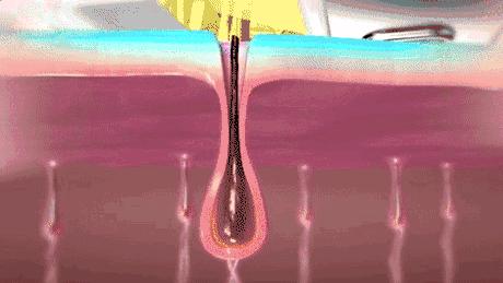 j-style脱毛仪测评,j-style美容仪好用吗