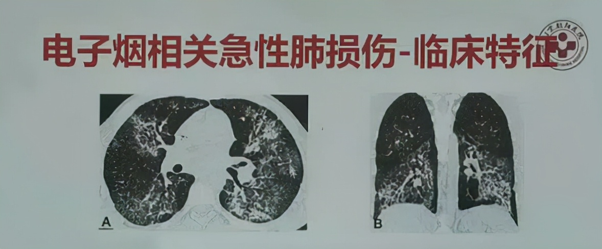 你抽的*子烟电**,让这个湖南老板身家640亿