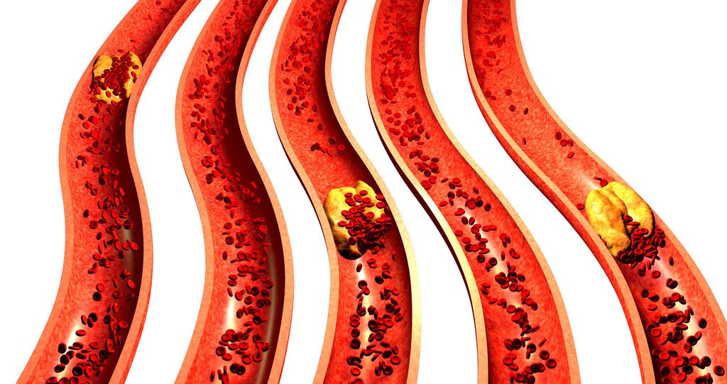 脑供血不足出现眩晕怎么办,脑供血不足会忽然视物模糊吗