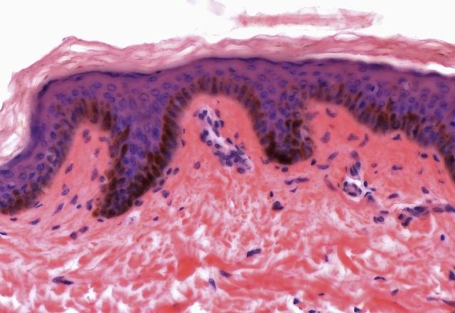 女性“下面”颜色深，是*生活性**频繁造成的吗？可能不是你想的那样