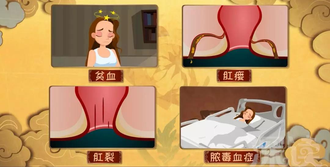第一次知道痔疮是什么样的感觉,得痔疮是哪里痛