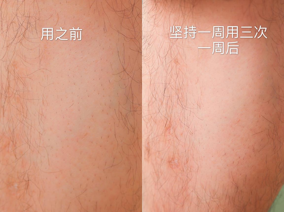 4款网红脱毛仪对比,ulike极萌脱毛仪涂鸦版