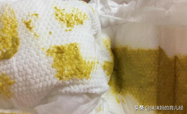 宝宝拉绿色便便还拉稀什么原因,宝宝拉绿色便便是感冒了
