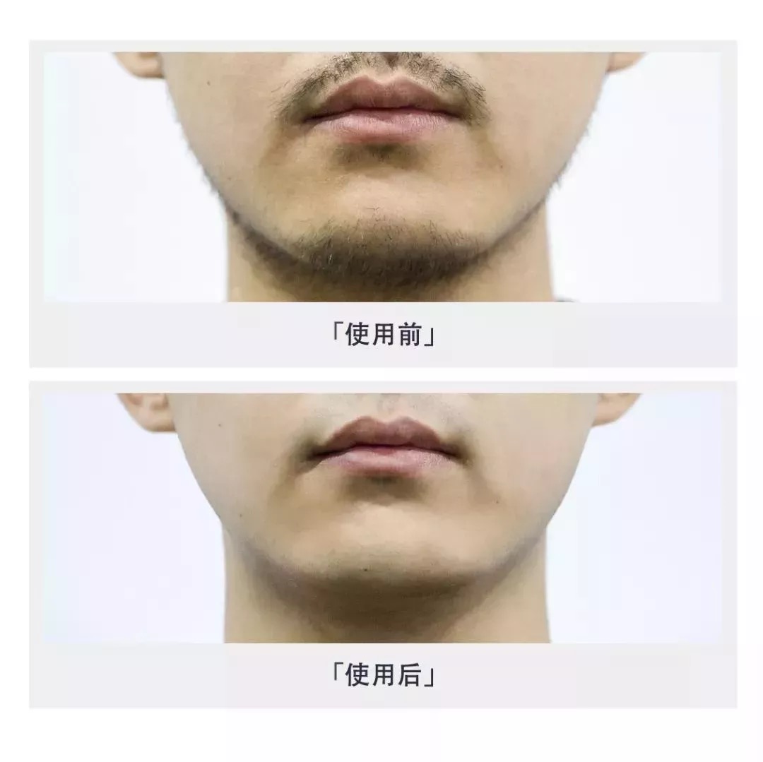 让男人们爽爆！你所烦恼的胡须，这次彻底给你解决了