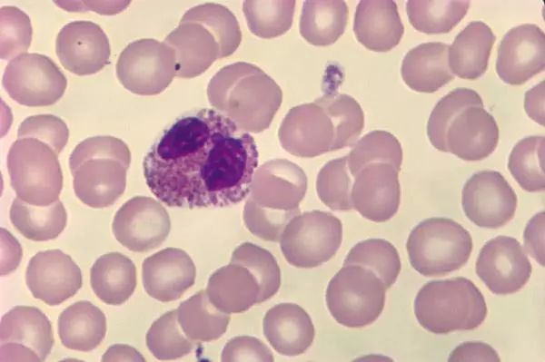 关于EGC身为铲屎官的你知多少？各种皮肤病都可能是EGC！