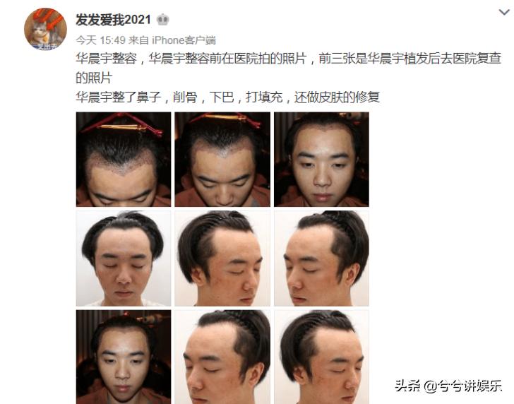 华晨宇和张碧晨传过绯闻吗,华晨宇承认和张碧晨已婚吗