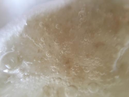 咽喉有痰胸口堵是什么原因,早上起床咽喉有黄痰是什么原因