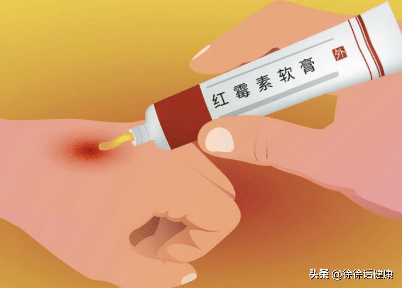 出门旅行必备物品排行榜,出行旅游必备收纳物品清单