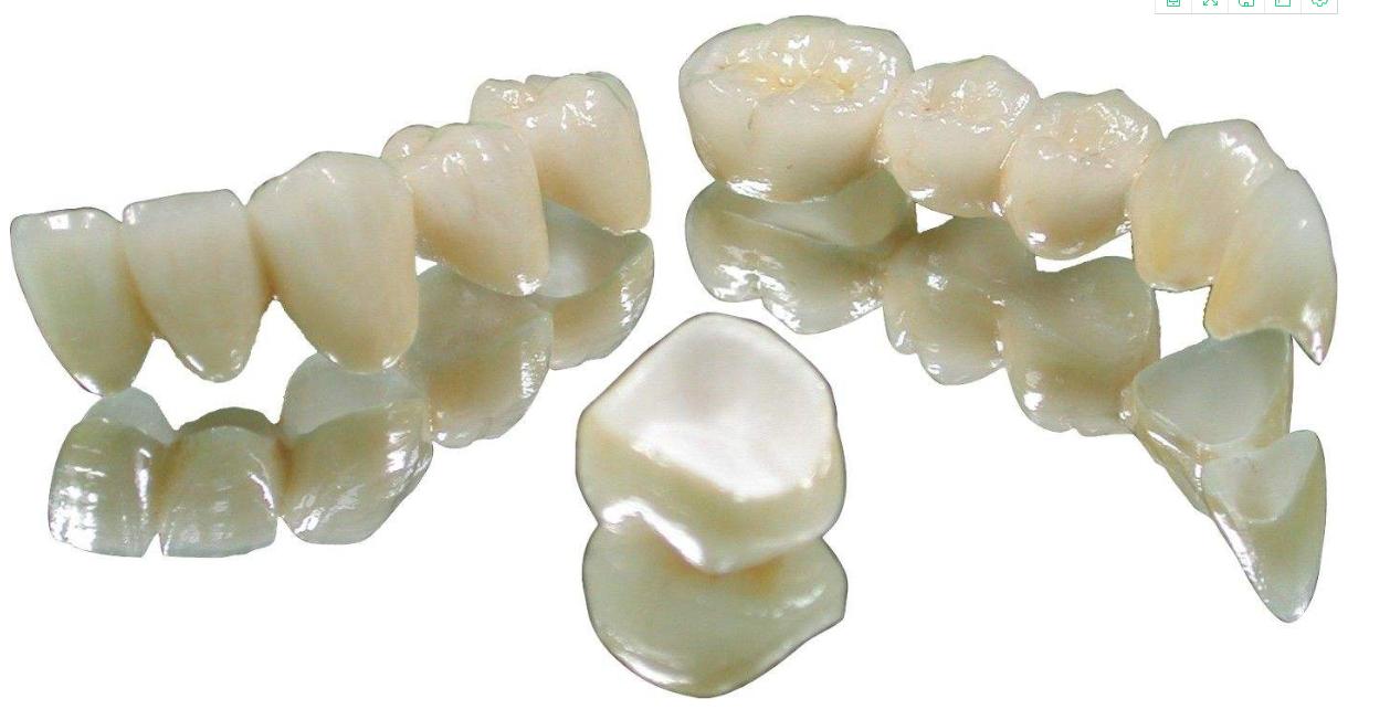 什么是美牙冠矫正,美牙冠对于龅牙效果好么