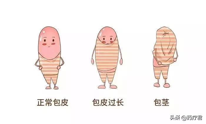 包皮几岁割比较好,男孩需不需要割包皮最合适