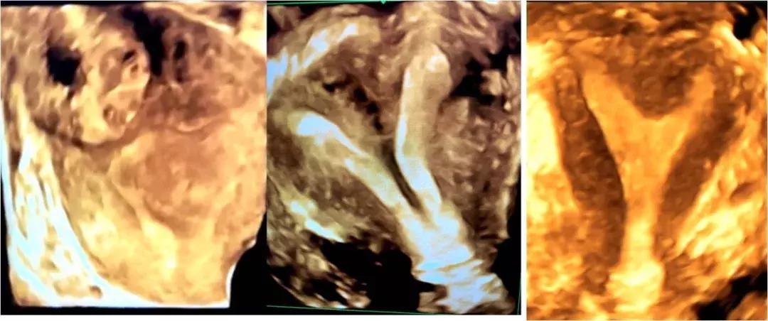 市中心医院超声科,商丘睢阳区中心医院超声科四维