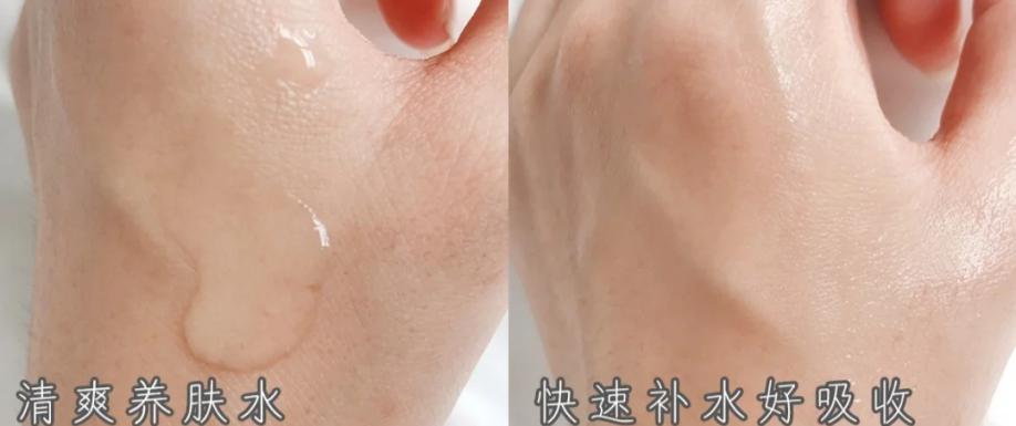 200左右性价比最高的保湿水乳,ahc水乳测评小神仙水乳痘肌