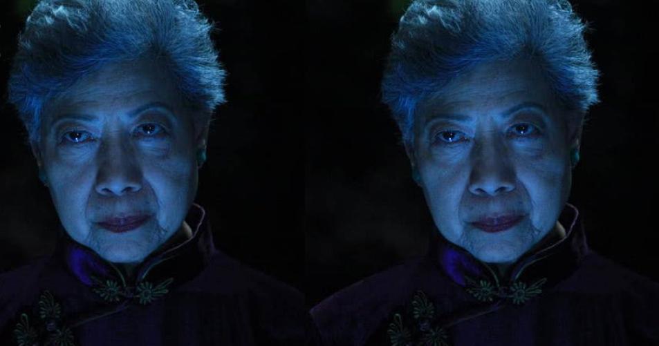 TVB*用御**“鬼婆”膝盖开刀仍隐隐作痛坚持康复训练与保持健康饮食