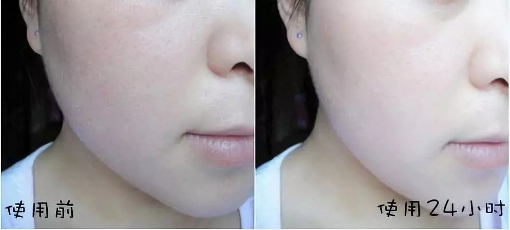 日本cosme大赏护肤榜,日本面膜cosme