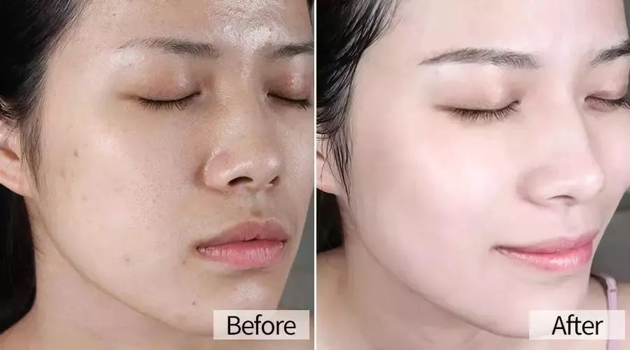 好用不起痘的洗面奶推荐,长期使用祛黑头洗面奶推荐