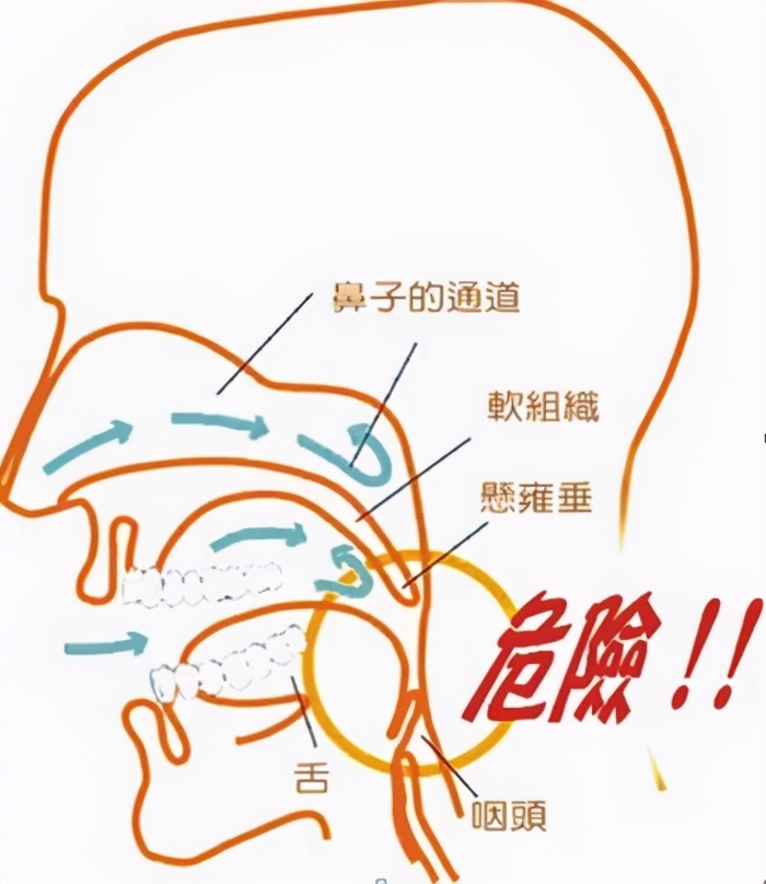 打鼾过程,打鼾呼吸机原理