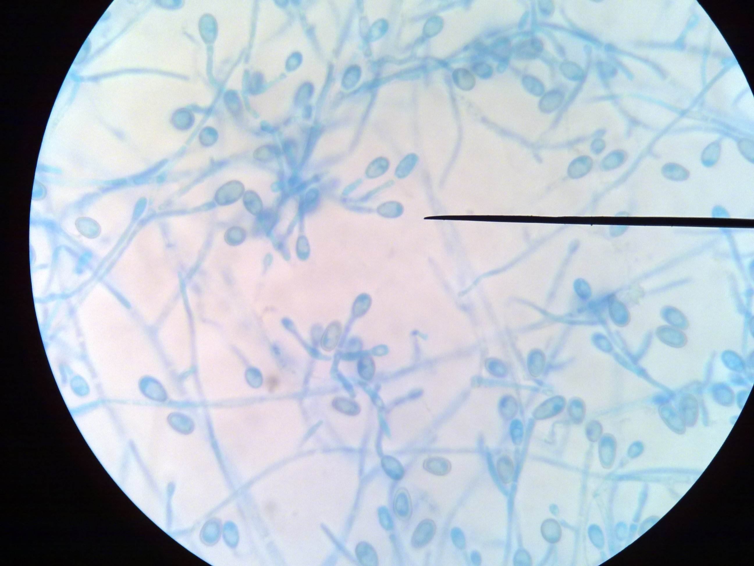 你对脚气、皮癣的致病菌了解多少？