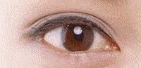 男生割内双眼皮手术,男子去割单眼皮后的结果