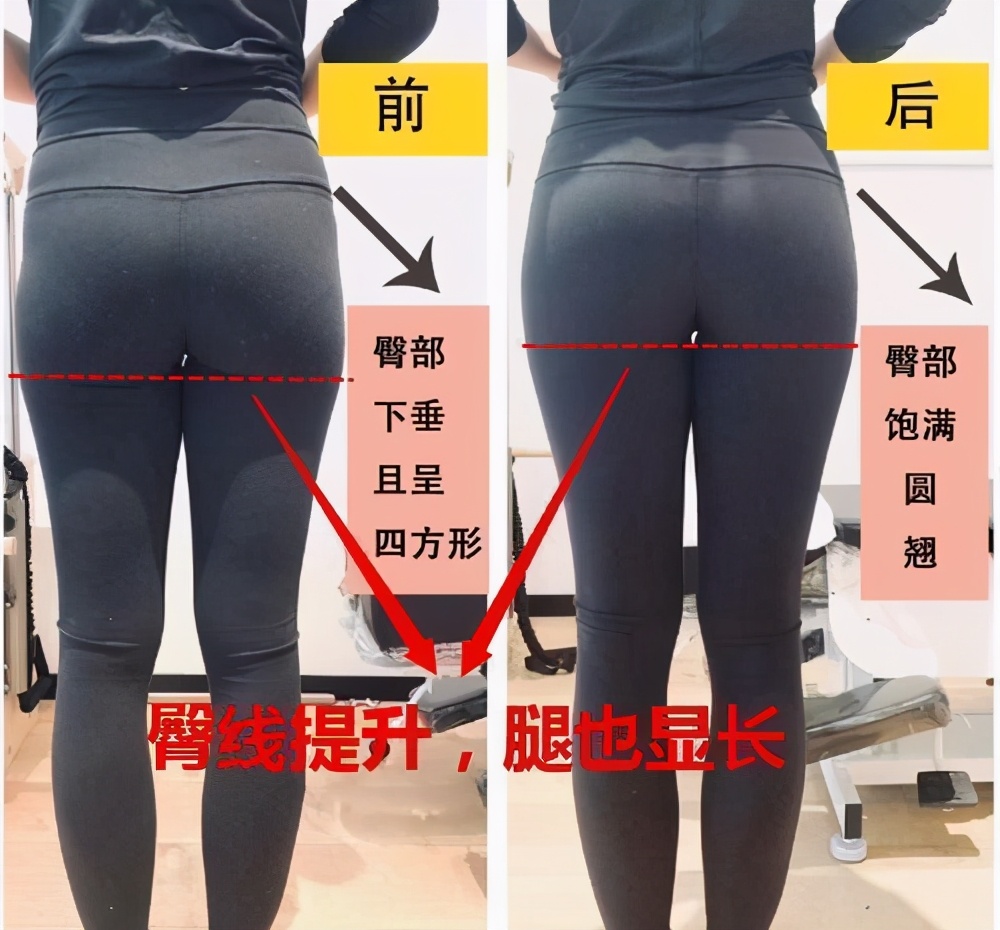 臀大肌无力会对步行有什么影响,臀大肌无力会引起腿疼吗