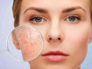 脸上毛孔粗大皮肤好粗糙怎么办,脸部皮肤粗糙毛孔粗大改善方法