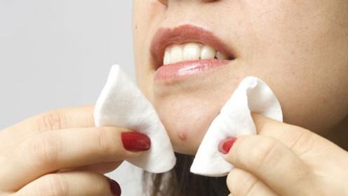 祛痘方法美妆博主,美妆护肤修复痘痘肌