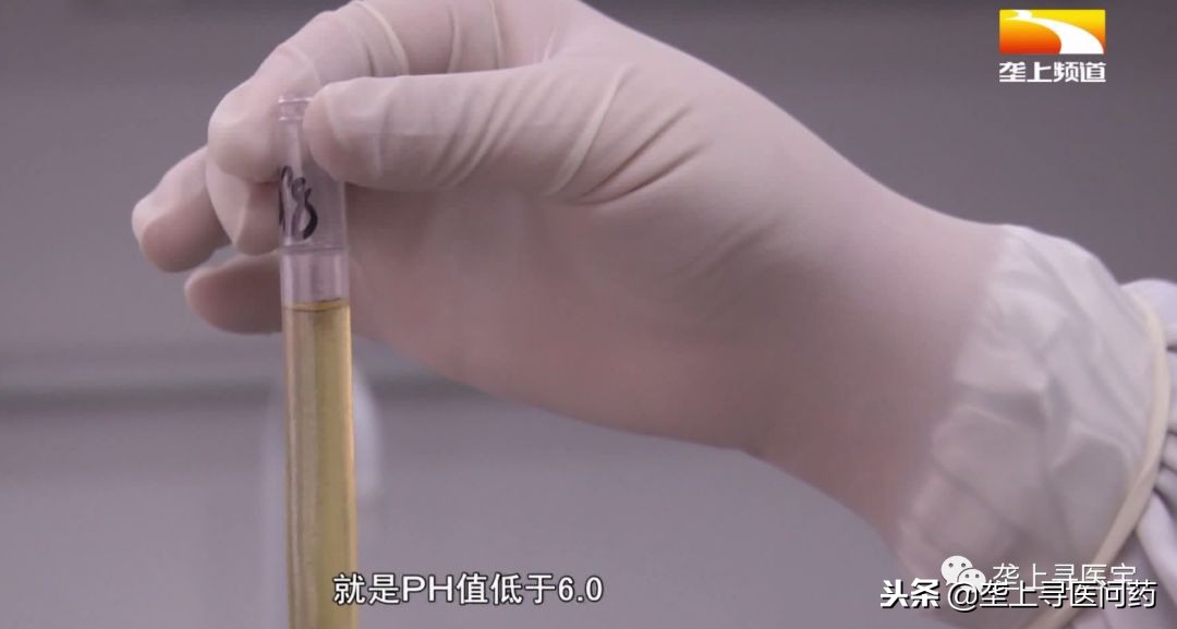 尿液可以保留多久才能做尿检,尿检前一天晚上需要注意什么