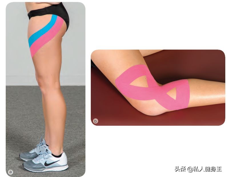 内旋型o型腿与外旋型o型腿的区别,40至50岁的o型腿能矫正过来吗