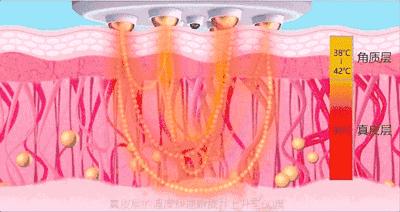 赵露思推荐好物清洁面部,赵露思推荐脸部小熨斗