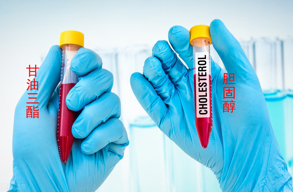 胆固醇和甘油三酯稍微偏高怎么办,胆固醇和甘油三酯同时升高怎么办