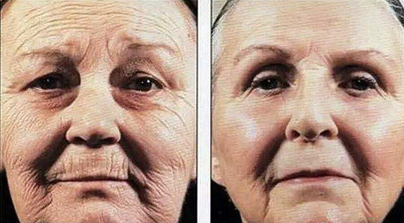 澳洲油皮防晒推荐哪款好用,澳洲清爽物理防晒霜好用吗