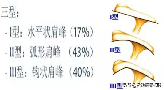 肩关节弹响的原因和解决办法,偏瘫患者肩关节弹响怎么回事