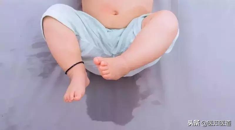 自闭症儿童5岁多还尿床有妙招吗,儿童憋尿能缓解尿床吗