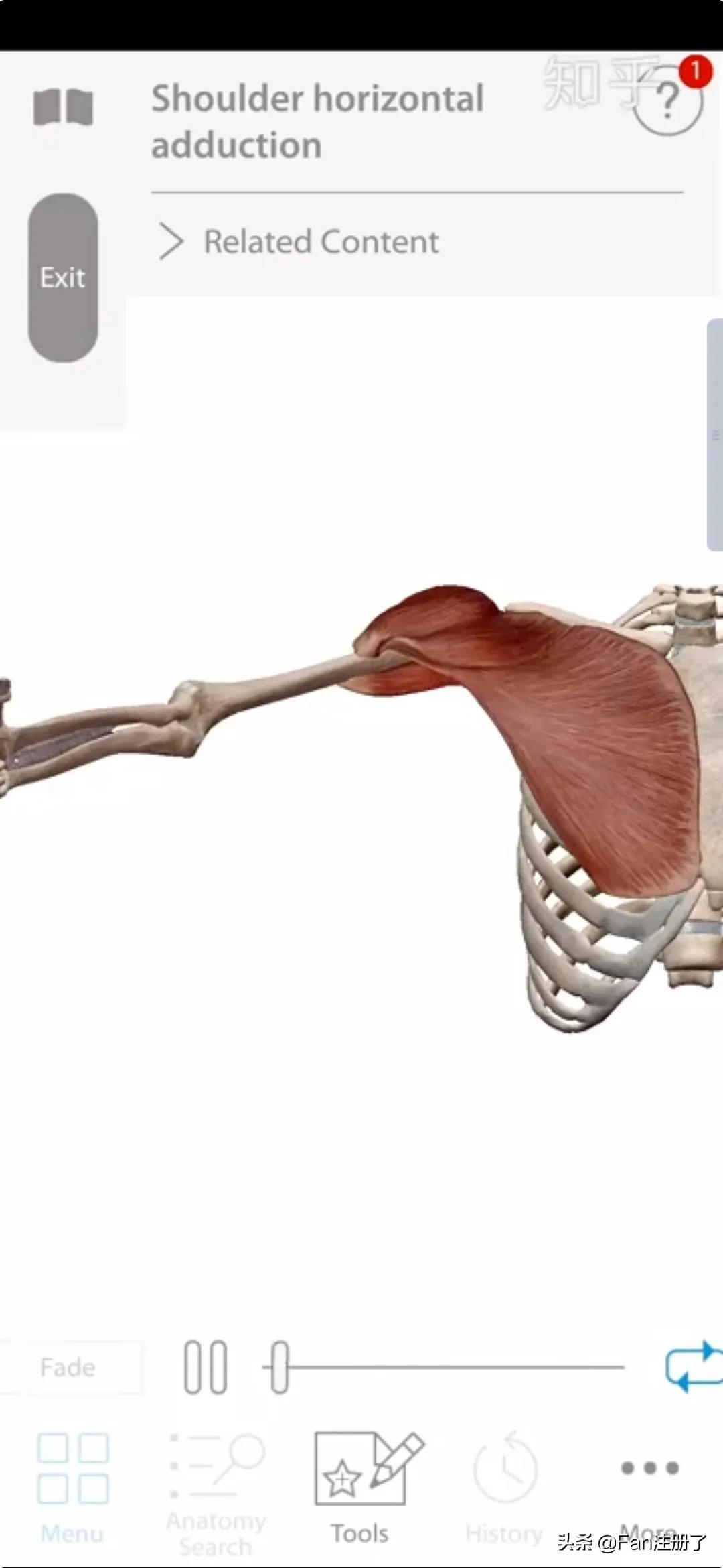 肩痛肩袖损伤针刀治疗,肩痛肩关节活动受限用什么药