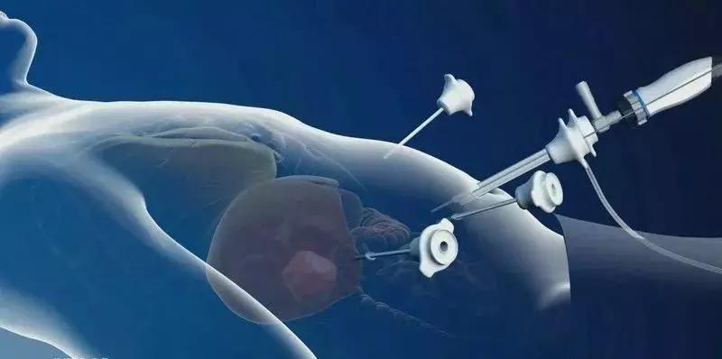 发现肝脏结节要做哪些检查,发现肝部有小结节用治疗吗