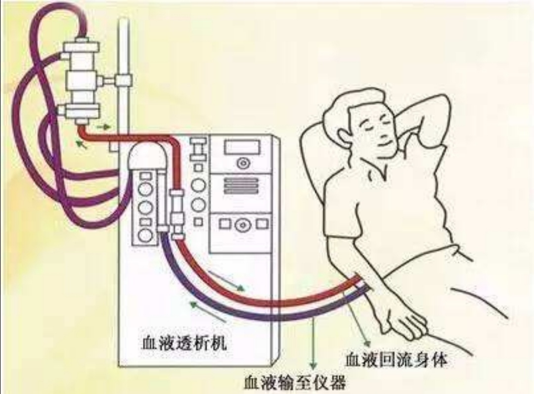 高钾血症的表现,高钾血症紧急处理