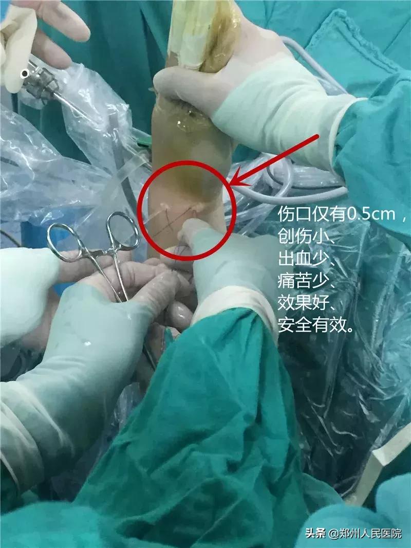 手腕疼10年了怎样治疗,20岁小伙手腕关节疼痛是怎么回事