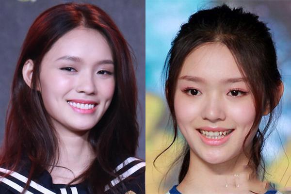 吴宣仪烤瓷牙怎么做,吴宣仪的整牙前