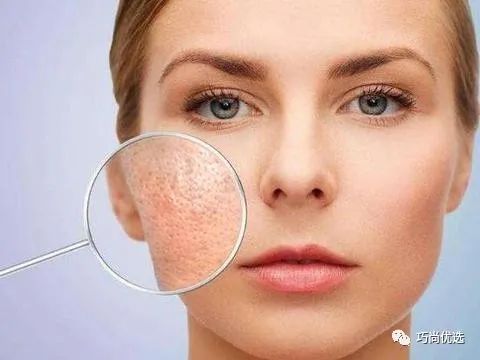 解决毛孔粗大的护肤品十大排名,鼻翼两侧毛孔粗大黑头怎么解决