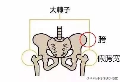 生完孩子假胯宽矫正的正确方法,假胯宽o型腿矫正的正确方法