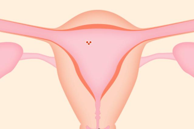 试管怀孕是辞职在家还是继续工作,要做试管婴儿要不要辞职