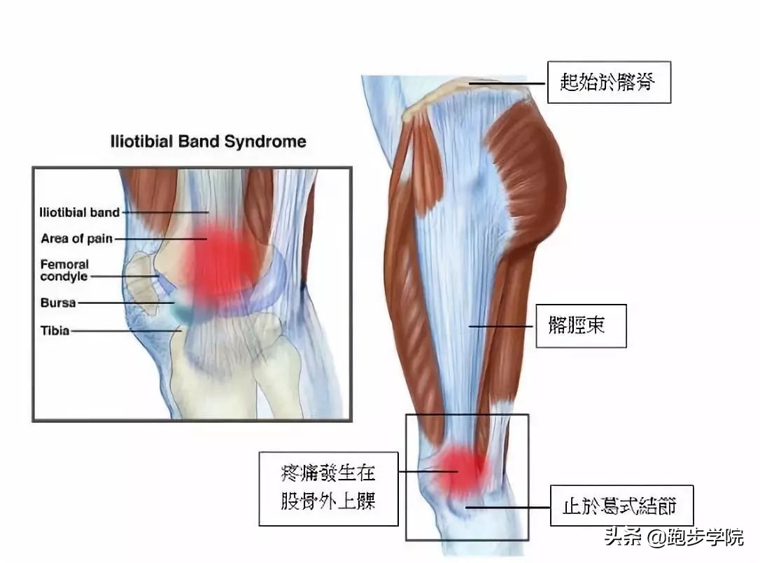 跑步膝盖痛该如何应对,关于跑步膝盖的损伤和恢复知识