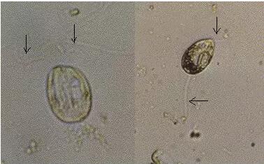 收藏!24种污水处理微生物菌相及指导意义,环保人必看(多图)