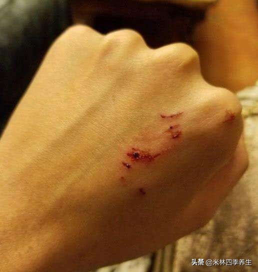 面对病毒,最好的办法就是增强免疫力,告诉你增强免疫力的方法