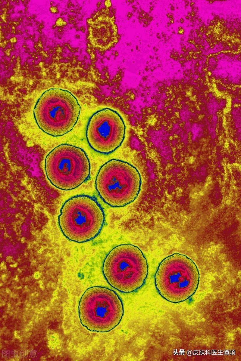 皮肤科疱疹治疗方法,生殖器疱疹怎么和家人解释