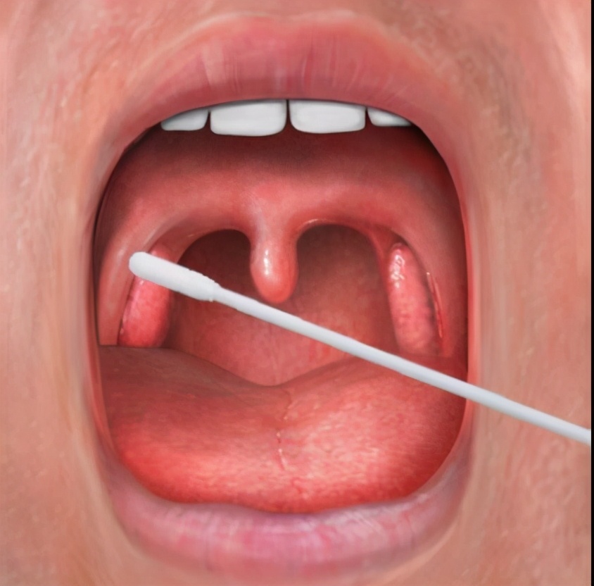 核酸检测正确自我保护方式,怎样克服核酸检测的恐惧