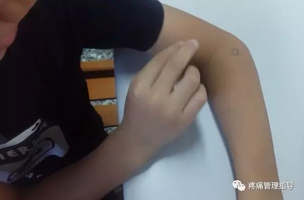 网球肘能自我恢复吗,网球肘病因的解剖学研究