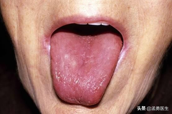 当你缺少蛋白质,身体缺乏的10种营养