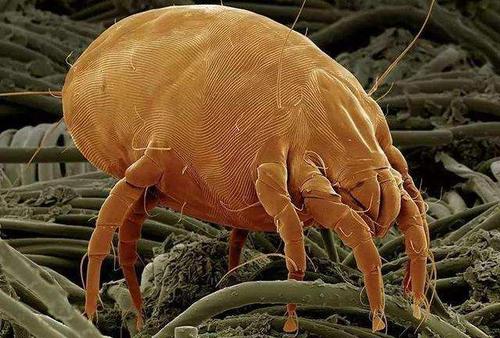 螨虫会导致背部泛红瘙痒,后背螨虫感染多长时间可以治愈